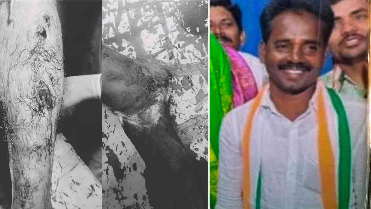 కాంగ్రెస్ నాయకుడు అంజి బీఆర్ఎస్ కార్యకర్తపై దాడి