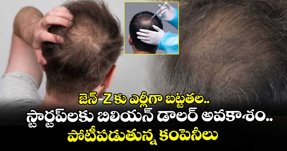 20 ఏళ్లకే బట్టతల: ఇండియాలో పెరుగుతున్న హెయిర్ కేర్ మార్కెట్